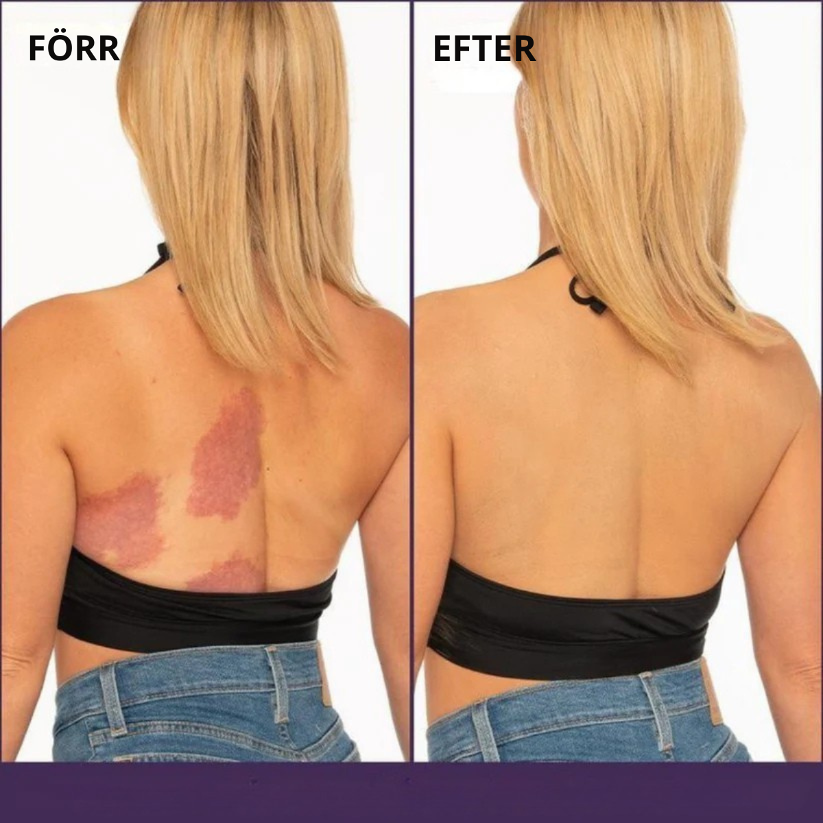 SovBättre - Ergonomisk foam kudde för bättre sömn och stöd till nacke.